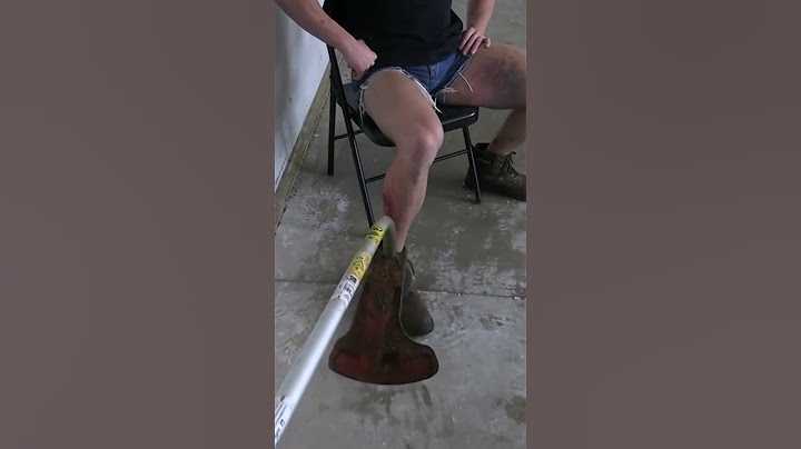 Creating the Worst WEED WACKER Injury… #fail #funny #experiment