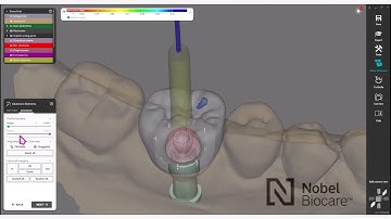 How to design your NobelProcera® Full-contour Zirconia Implant Crown using exocad™