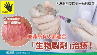 【銀屑病知多少】接受生物製劑治療前的準備