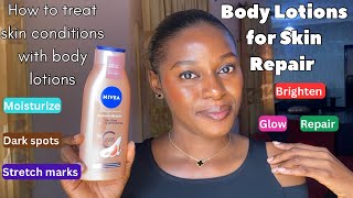 Body lotions for hyperpigmentation/ how to use body lotions to treat different skin conditions
