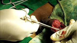 Circumcision Operation, Sunnat Surgery at Elegance Clinic, Surat, Gujarat, India.