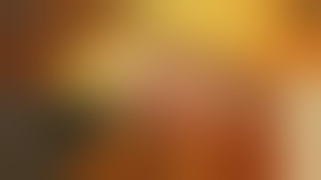 Volar Approach Scaphoid