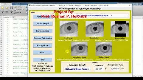 Iris Recognition Using  Matlab Project Source Code Final Year Project