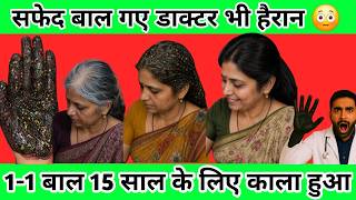 अरे 😍 वा काश,मुझे पहले पता होता, 11साल से थे सफेद बाल,4 दिन में काले हुए
