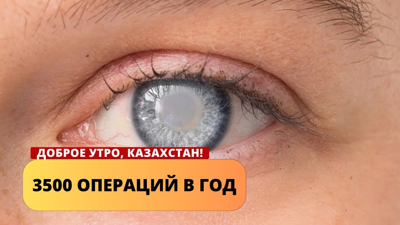 3500 ОПЕРАЦИЙ В ГОД: НИИ ГЛАЗНЫХ БОЛЕЗНЕЙ В ШЫМКЕНТЕ - YouTube