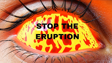 The Science of Anger: How to Stop an Amygdala Hijack in 5 Seconds