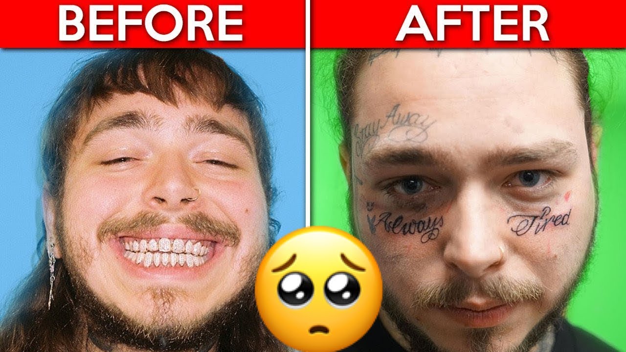 Post Malone's Drug Addiction Is SCARING Us - The Real reason fans are worried about him