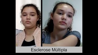 Vitória - Esclerose Múltipla