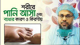 শরীরে পানি আসা এবং ব্যথার কারণ ও কিরণীয় | Symptom, Causes & Treatment