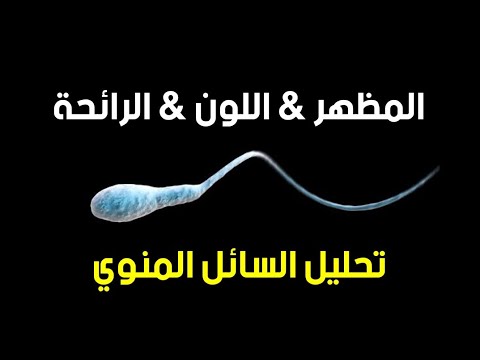 فيديو: الرائحة الشائعة