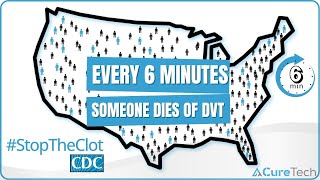 CureTech DVT Prevention | #StopTheClot