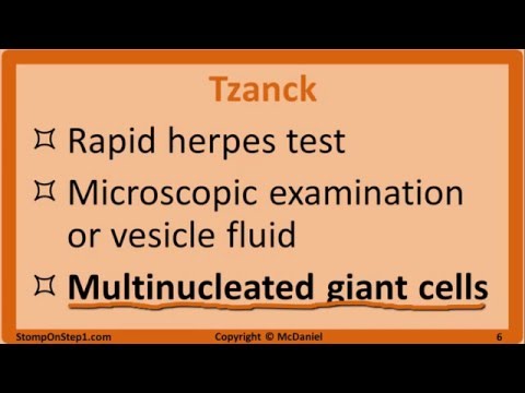 Herpes: Mono, HSV, Chickenpox, Shingles, EBV, CMV, Cold Sore, VZV Varicella