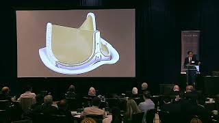 Choosing the best aortic valve substitute: Mechanical, Tissue, or Ross – why and how - Joseph Woo