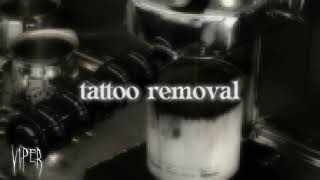 tattoo removal. screenshot 3