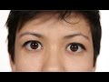 East Asians Test Double Eyelid Products