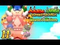 Youtube Thumbnail title