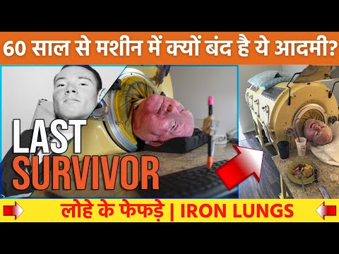 60 साल से मशीन में बंद है यह आदमी | IRON LUNGS Polio Paul Alexander #shorts #gyanhubindia