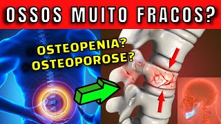 5 DICAS PARA MELHORAR a OSTEOPENIA e OSTEOPOROSE | SINTOMAS DE OSSOS FRACOS