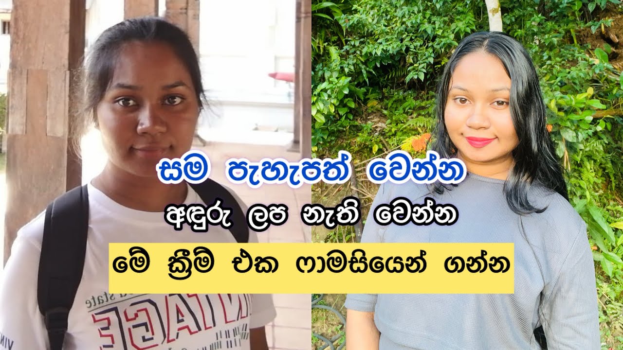 සම පැහැපත් වෙන්න අඳුරු ලප නැති වෙන්න මේ ක්‍රීම් එක ෆාමසියෙන් ගන්න