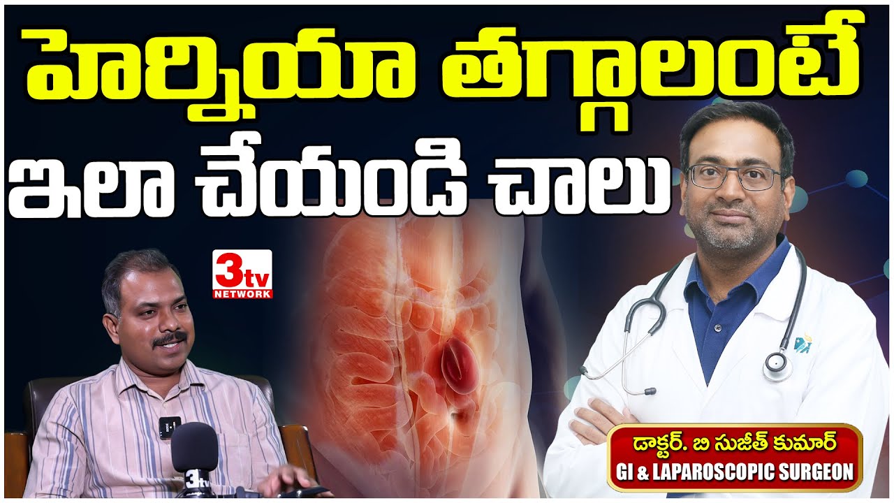 హెర్నియా తగ్గాలంటే మందులు వాడాలా సర్జరీనే మార్గమా I Hernia Treatment Options I Dr Sujeeth Kumar