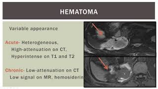 The retroperitoneum screenshot 5