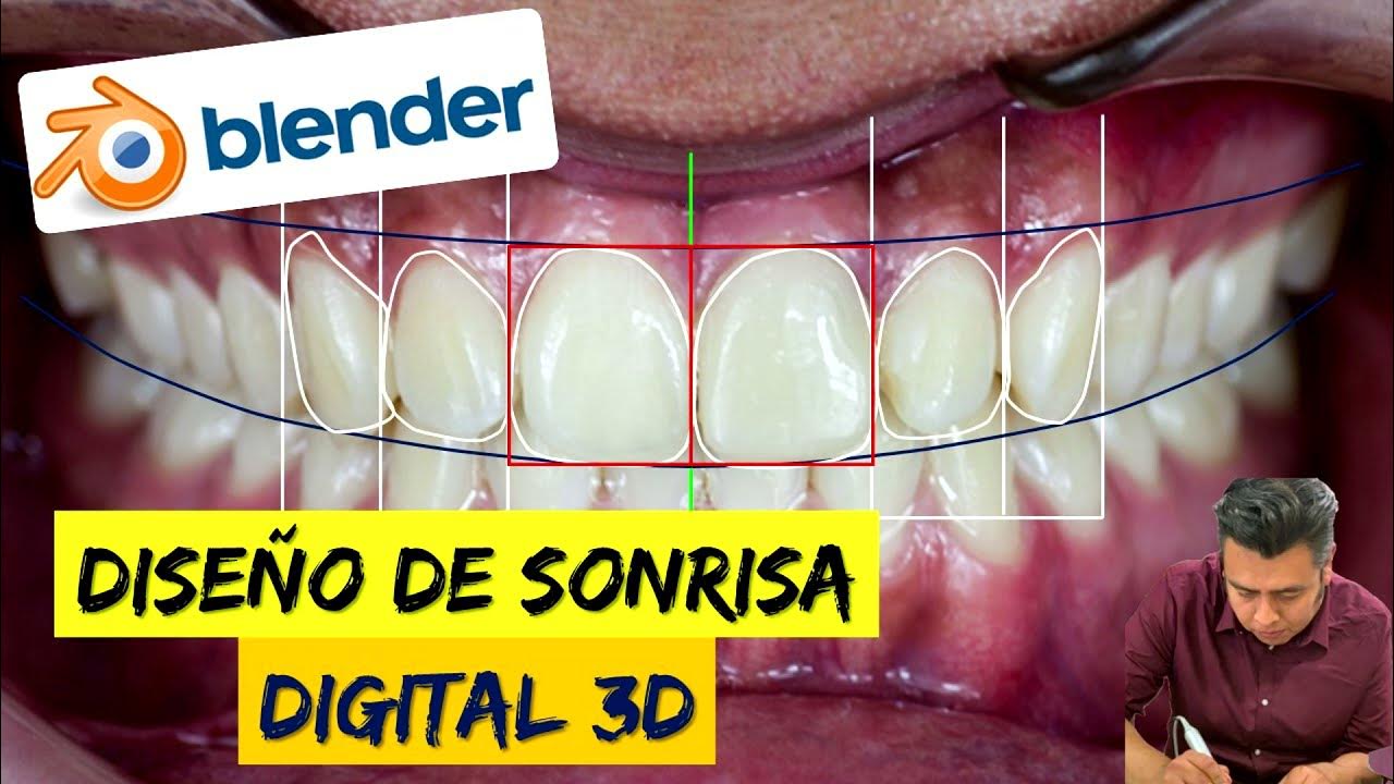 REALIZA un DISEÑO DE SONRISA 3D en BLENDER Dental Mode YouTube