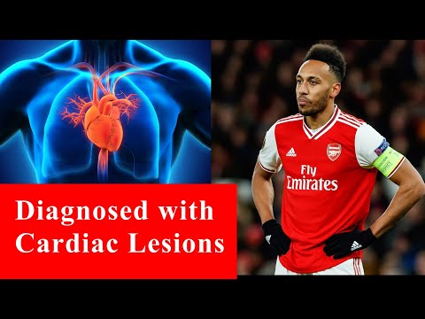 Pierre Aubameyang  diagnosed with  cardiac lesions at the Africa Cup of Nations  #Aubameyang