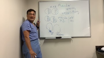 Macular sparing and macular splitting
