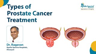 Prostate Cancer – Diagnosis \& Treatment | Dr. N Ragavan