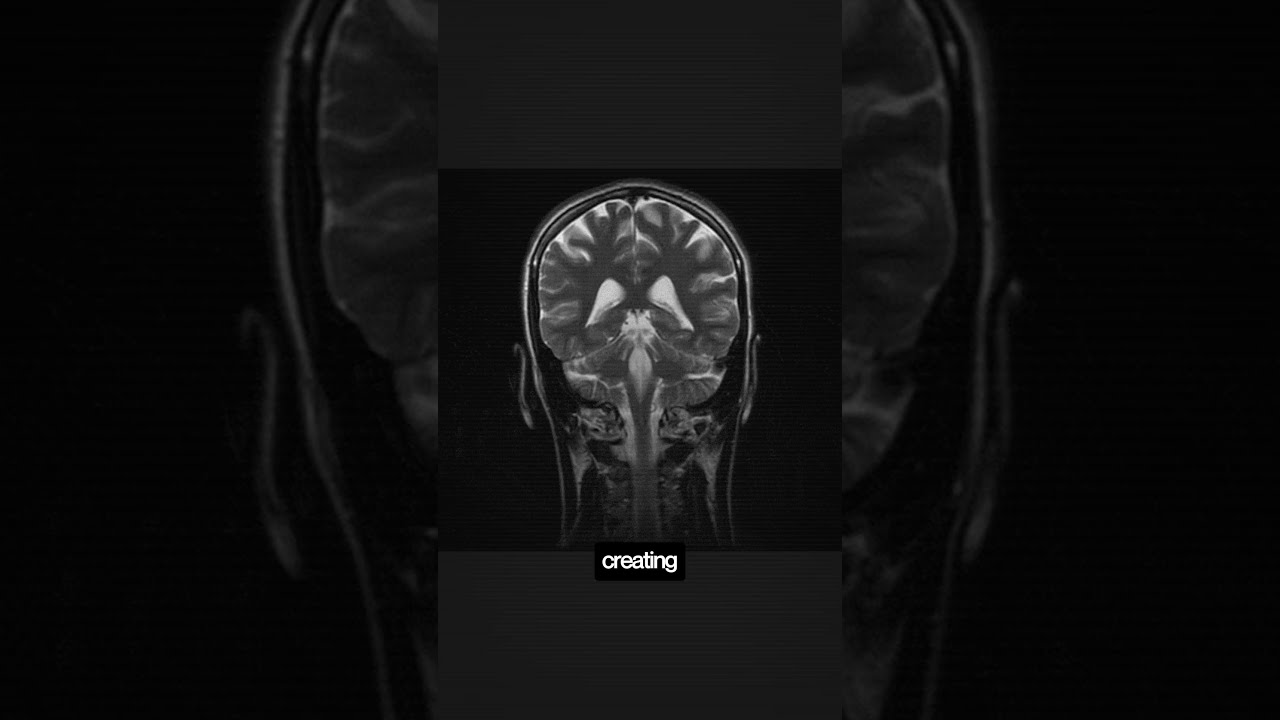 Open Memory MCP The End Of Dumb AI Tools Ai Mcp N8n