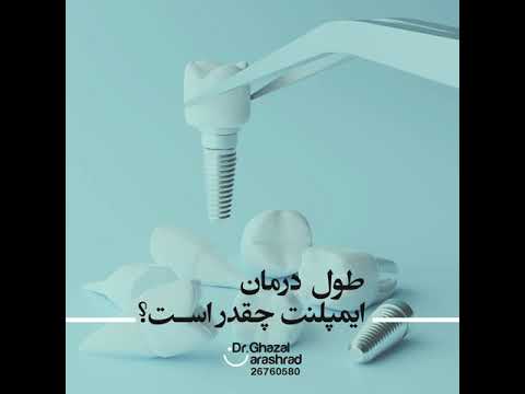 طول درمان ایمپلنت دکتر غزال آرش راد
