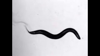 Famous Swimming C.elegans Profile