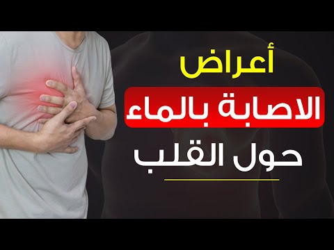 أعراض الماء حول القلب