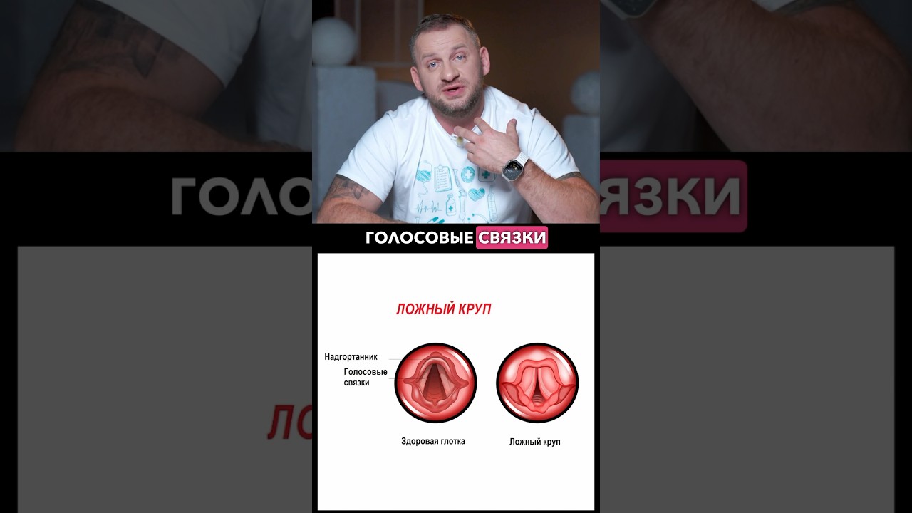 Что такое ложный круп и как его лечить