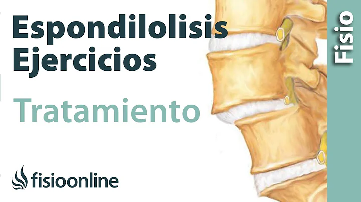 Espondilolisis y espondilolistesi...  - Tratamient...
