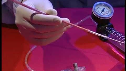 Ultraxx Nephrostomy Balloon Product Demo