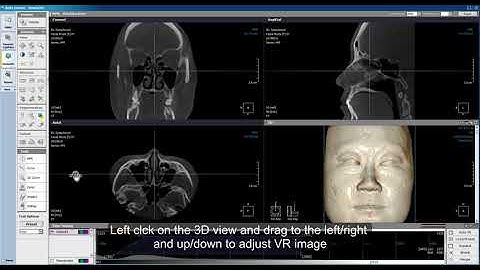 Xelis Dental Case Tutorial Adjusting VR Image