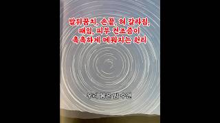 발뒤꿈치, 손끝, 혀 갈라짐, 꺼짐, 패임, 피부 건조증이 촉촉하게 메꿔지는 원리