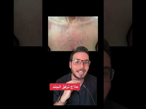 علاج ترقق الجلد 