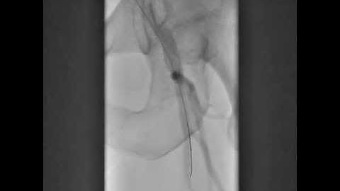 CrossBoss SFA CTO #1