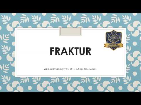 Video: Fraktur Av Fibula - Symtom, Diagnos, Behandling