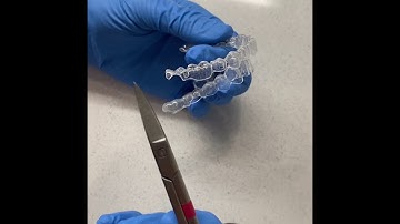 Clear aligner cut outs for elastics