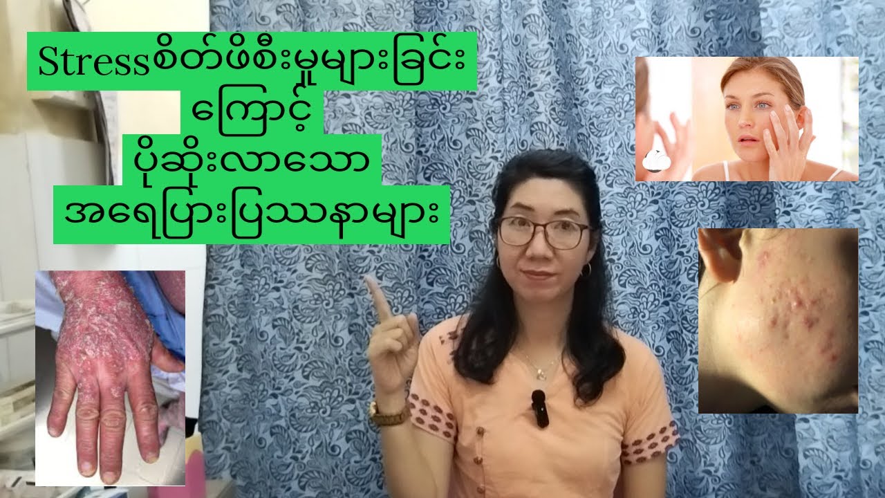 Stress can trigger your skin problems စိတ်ဖိစီးမှုကြာင့်ပိုဆိုးသွားနိုင်တဲ့အ‌ေရပြားရောဂါ၊ပြဿနာများ