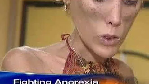 Anorexia's Childhood Roots (CBS News)