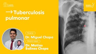 Tuberculosis pulmonar por el Dr. Miguel Chapa.