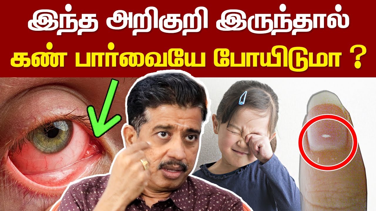 இந்த அறிகுறி இருந்தால் கண் பார்வையே போய்டுமா ? | Dr Gopinath Interview about Diabetic Retinopathy