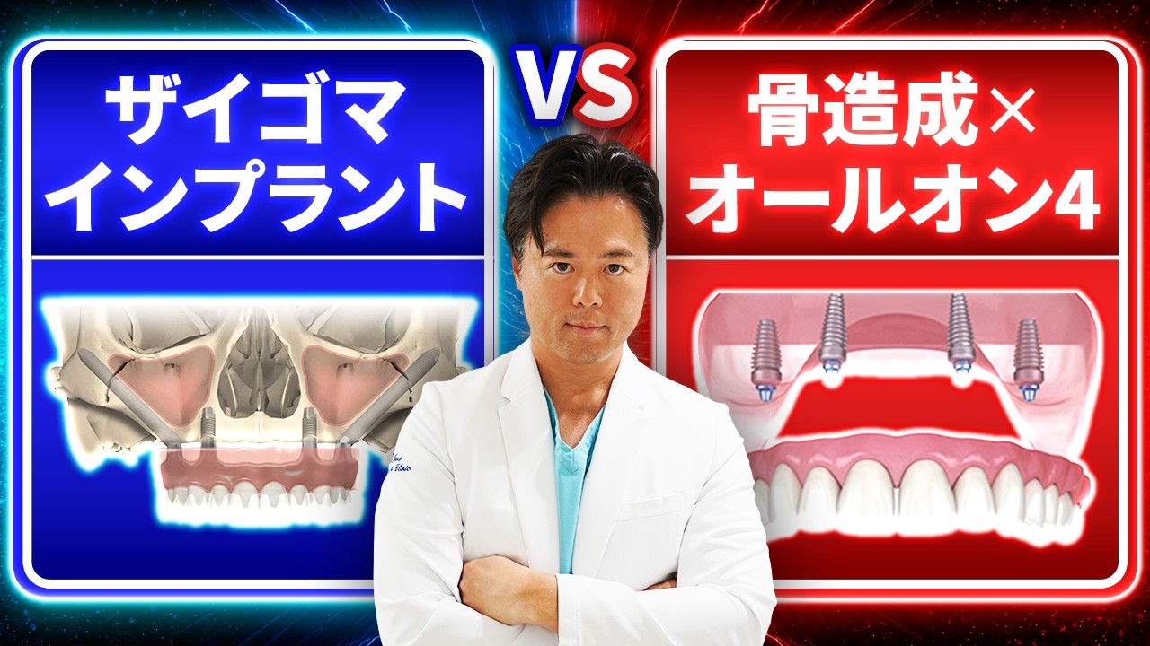 Must-watch if you were told you can't get All-on-4 due to bone