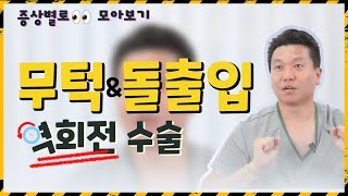 무턱, 돌출입, 긴 얼굴 👀 역회전 양악 수술에 관한 모든 것 l 증상별로 모아보기 l 얼굴뼈주민센터