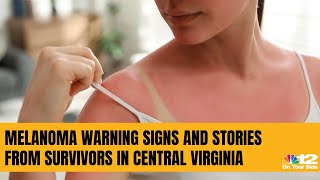 Safety in the sun: Melanoma cases are on the rise