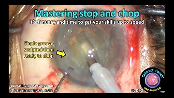 CataractCoach™ 2090: mastering stop and chop phaco technique